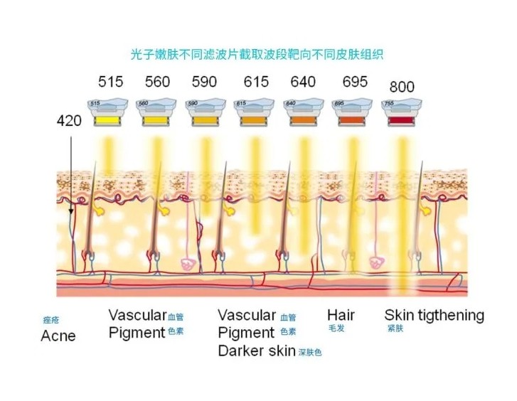 五大光子嫩膚技術(shù)（IPL、DPL、OPT、APT、BBL）及濾光片區(qū)別