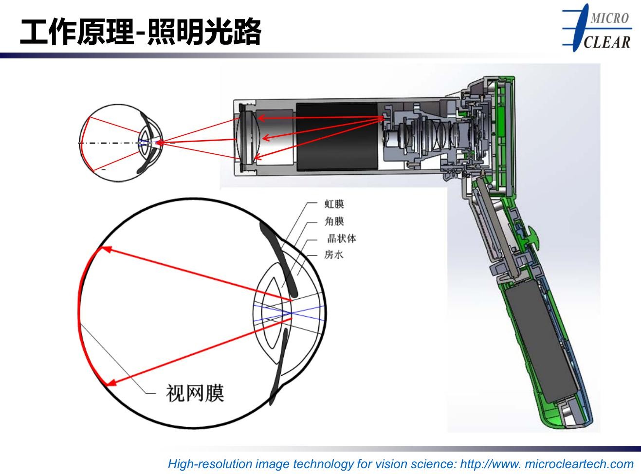 手持眼底相機